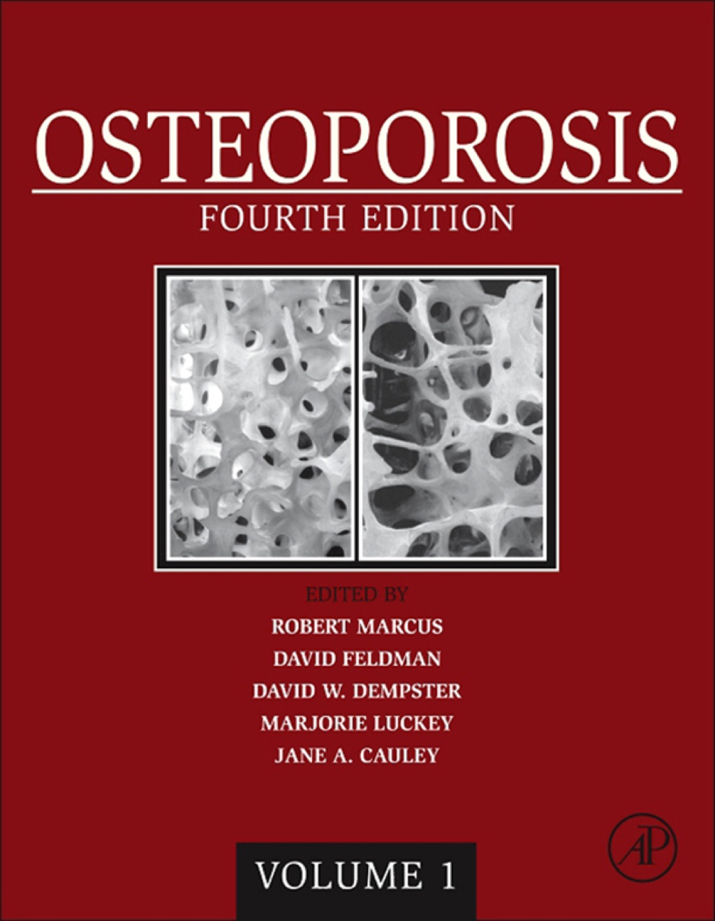 Osteoporosis 4th Edition â€“ PDF/EPUB Version Downloadable