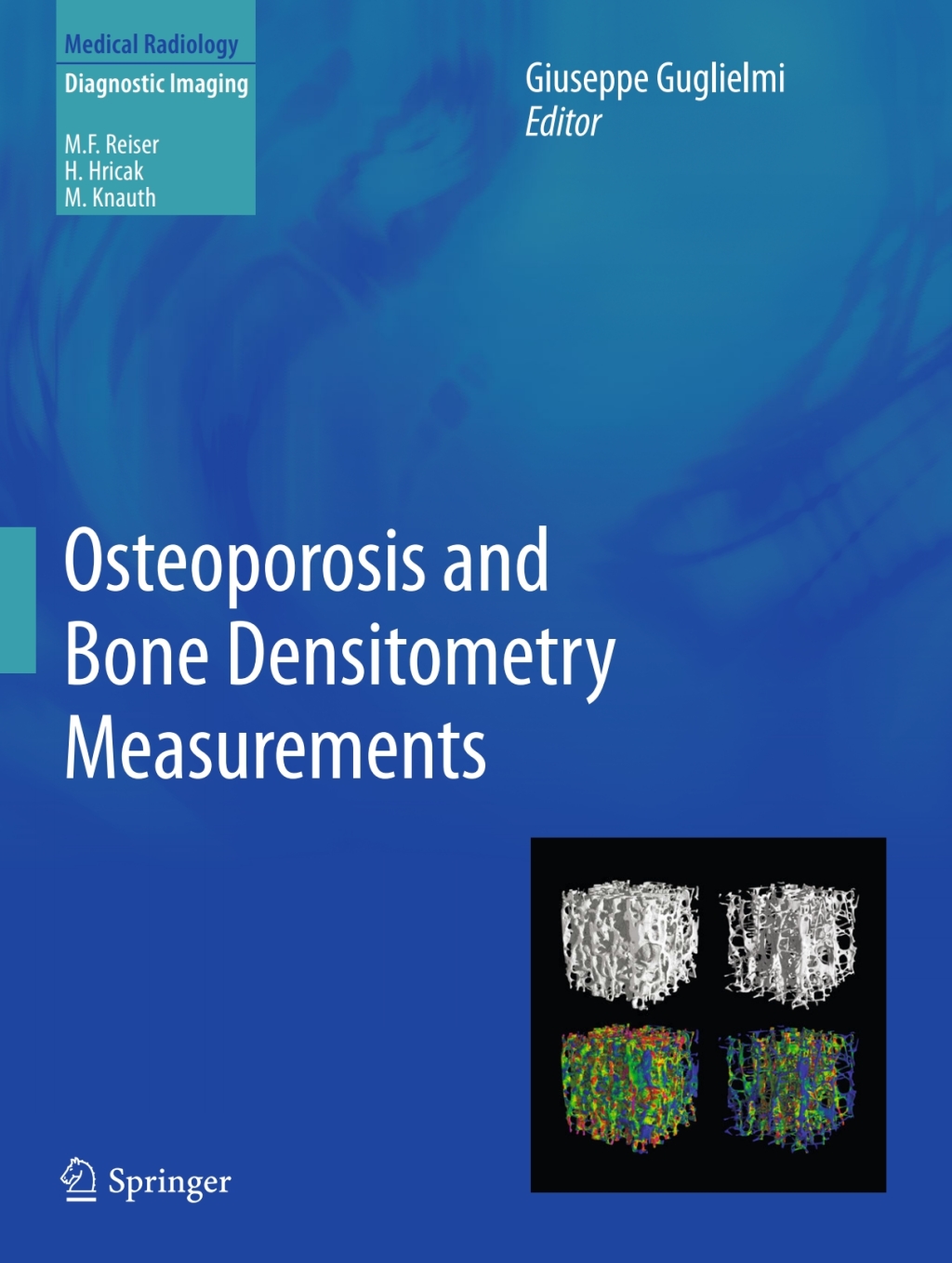 Osteoporosis and Bone Densitometry Measurements  â€“ PDF/EPUB Version Downloadable