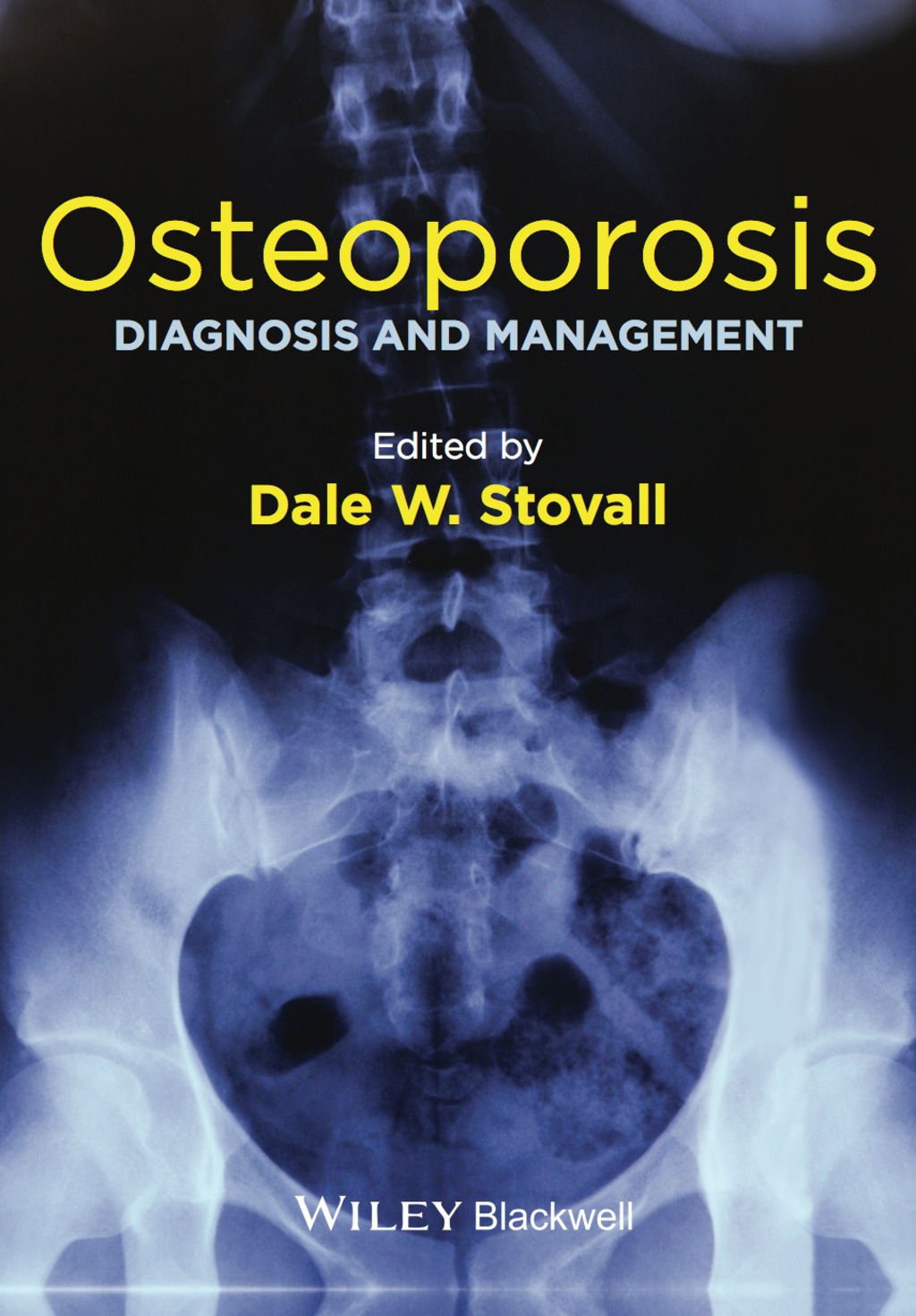 Osteoporosis: Diagnosis and Management 1st Edition â€“ PDF/EPUB Version Downloadable