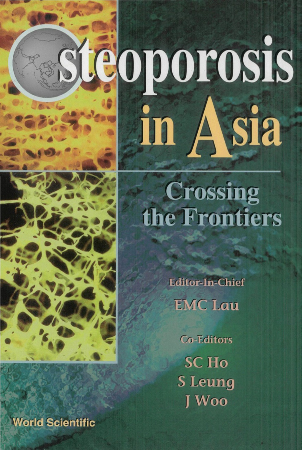 Osteoporosis In Asia: Crossing The Frontiers 1st Edition â€“ PDF/EPUB Version Downloadable