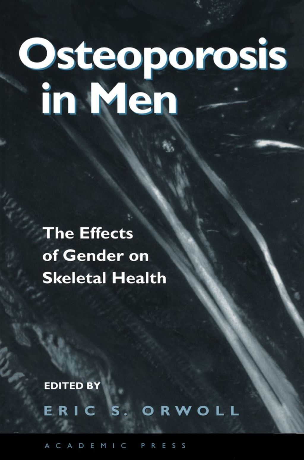 Osteoporosis in Men: The Effects of Gender on Skeletal Health  â€“ PDF/EPUB Version Downloadable