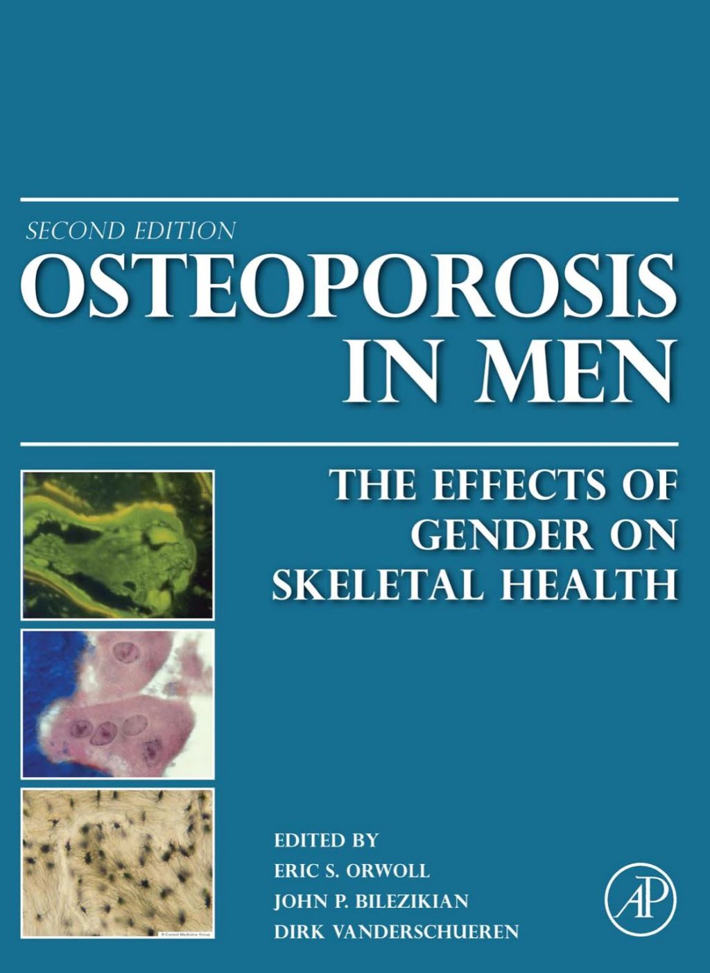 Osteoporosis in Men: The Effects of Gender on Skeletal Health 2nd Edition â€“ PDF/EPUB Version Downloadable