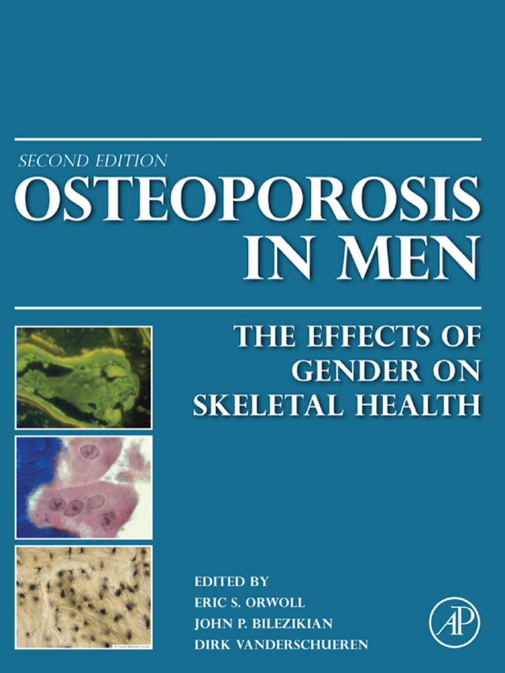 Osteoporosis in Men: The Effects of Gender on Skeletal Health 2nd Edition â€“ PDF/EPUB Version Downloadable