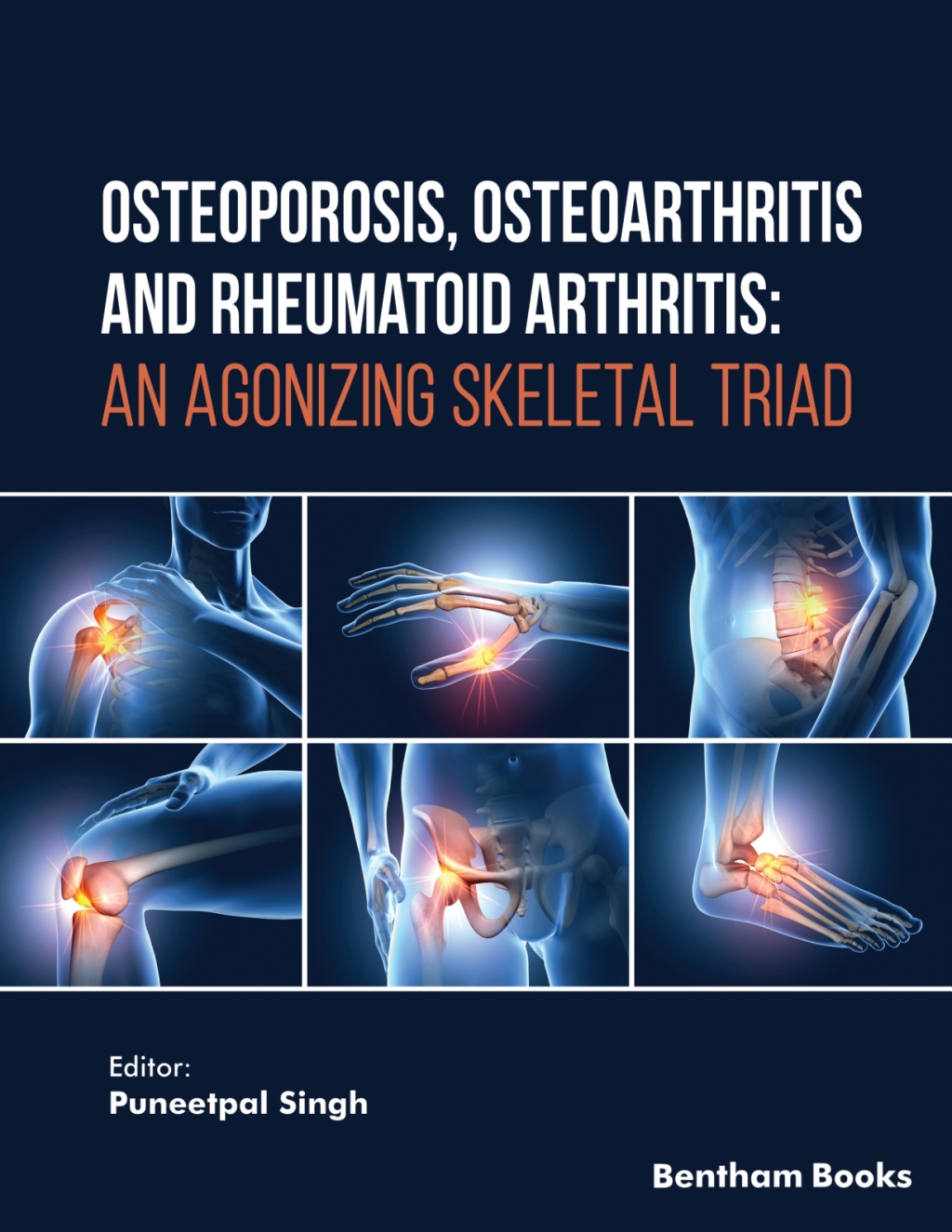 Osteoporosis, Osteoarthritis and Rheumatoid Arthritis: An Agonizing Skeletal Triad 1st Edition â€“ PDF/EPUB Version Downloadable