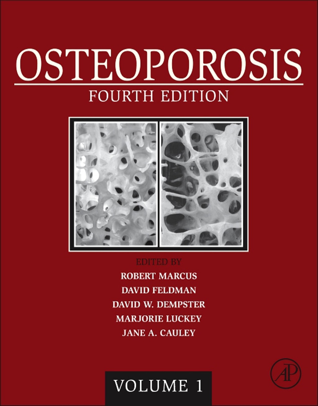 Osteoporosis: Two-Volume Set 4th Edition â€“ PDF/EPUB Version Downloadable