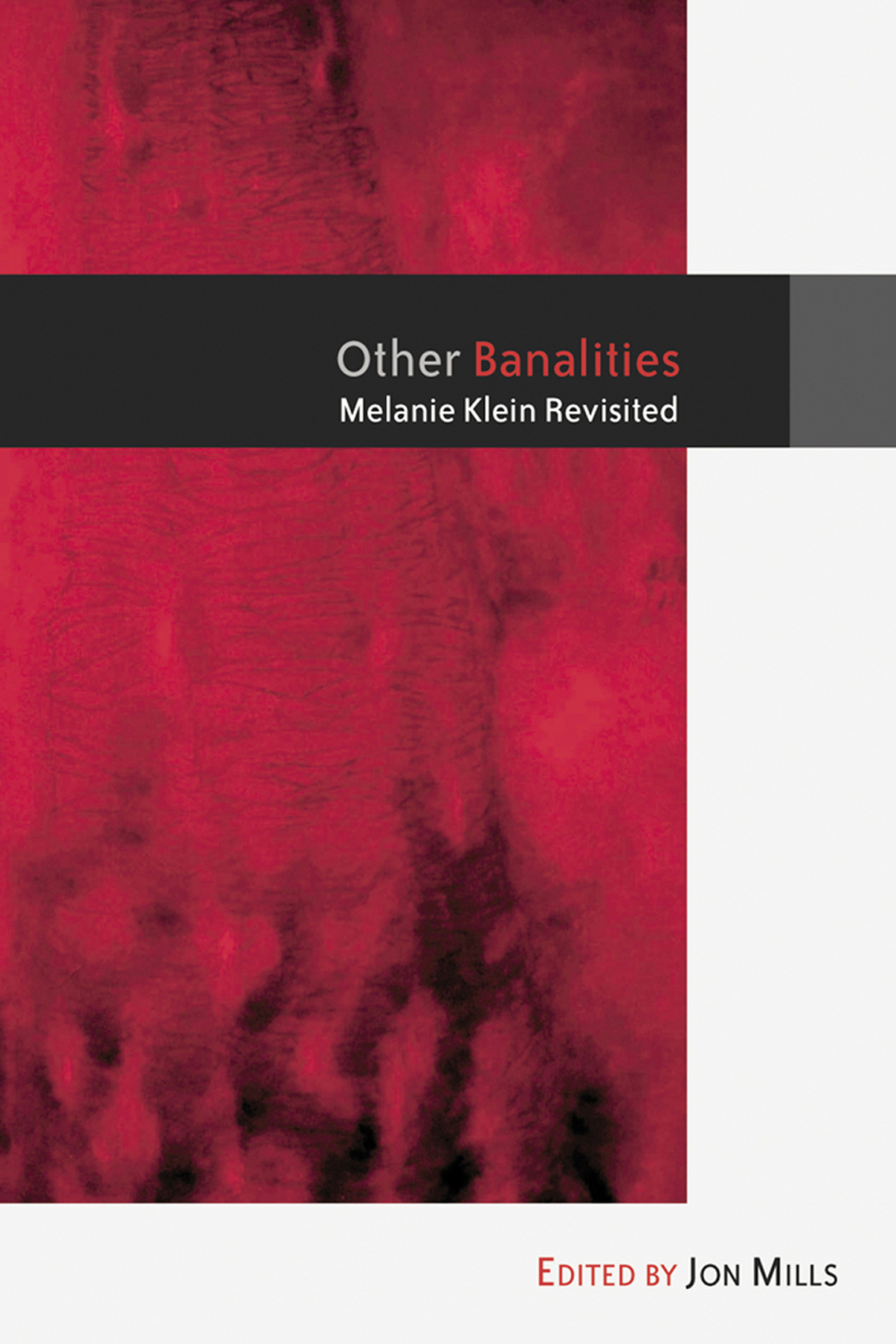 Other Banalities Melanie Klein Revisited 1st Edition - (PDF/EPUB Version)