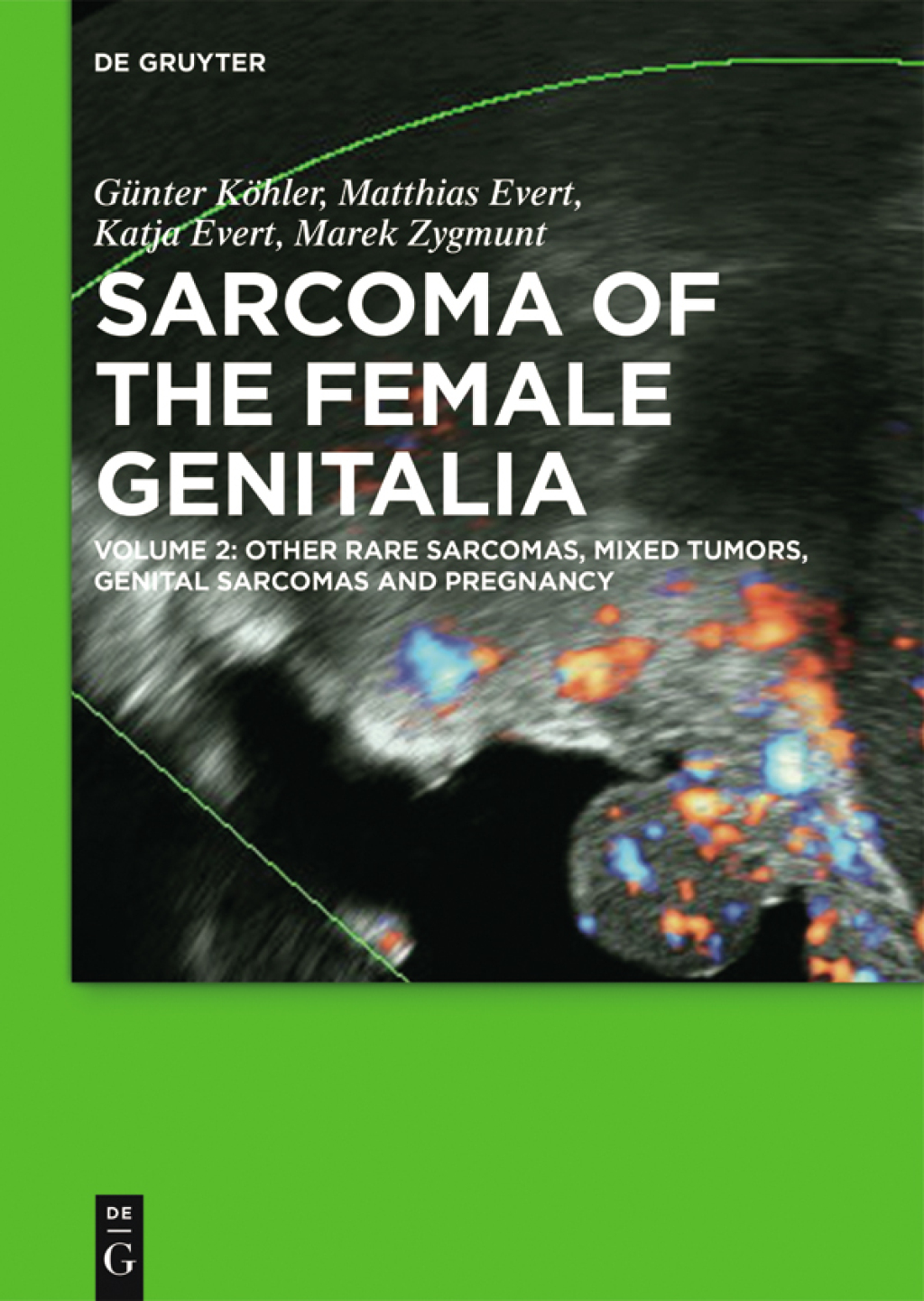 Other Rare Sarcomas, Mixed Tumors, Genital Sarcomas and Pregnancy 1st Edition â€“ PDF/EPUB Version Downloadable