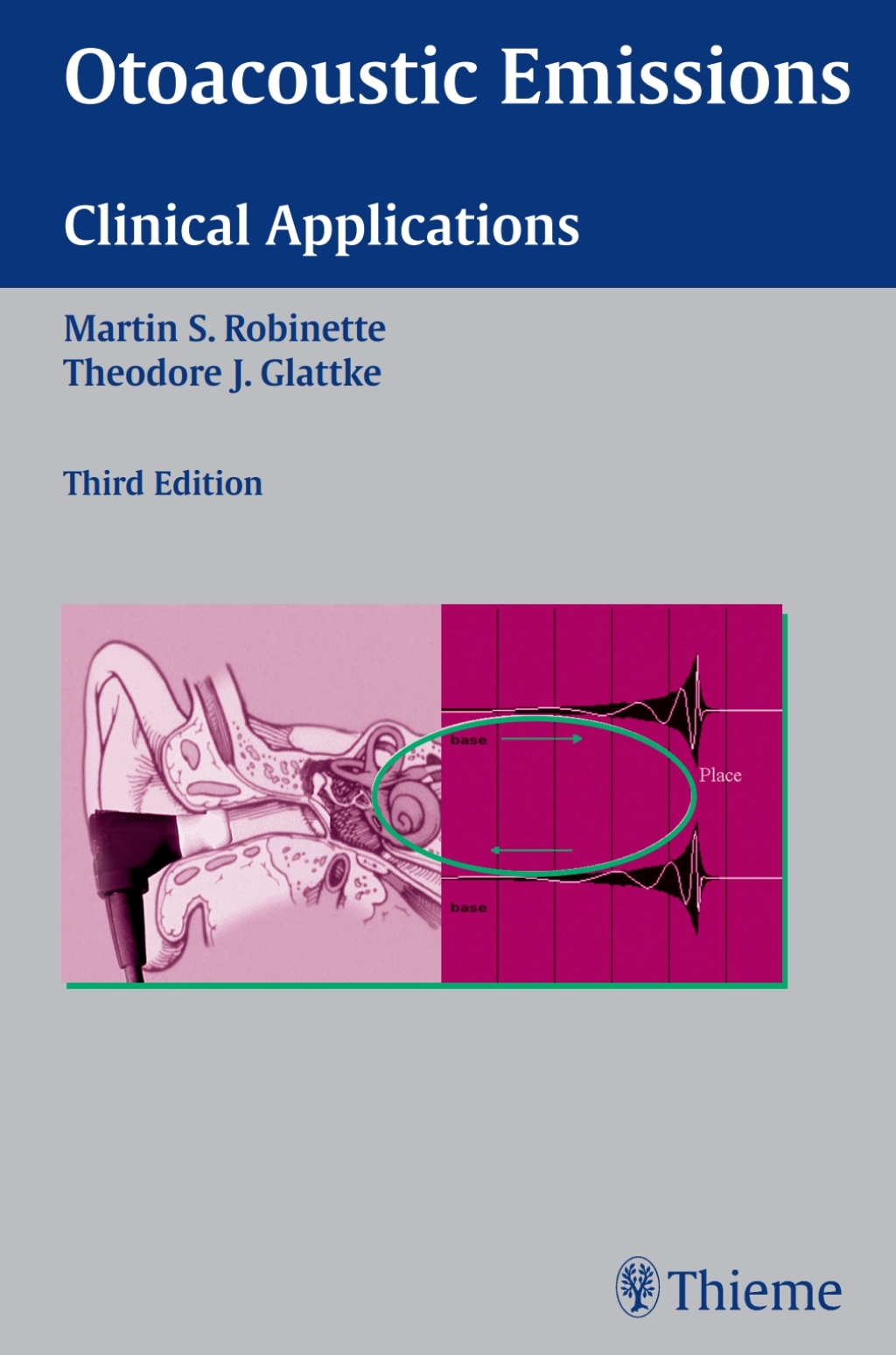 Otoacoustic Emissions Clinical Applications 3rd Edition â€“ PDF/EPUB Version Downloadable