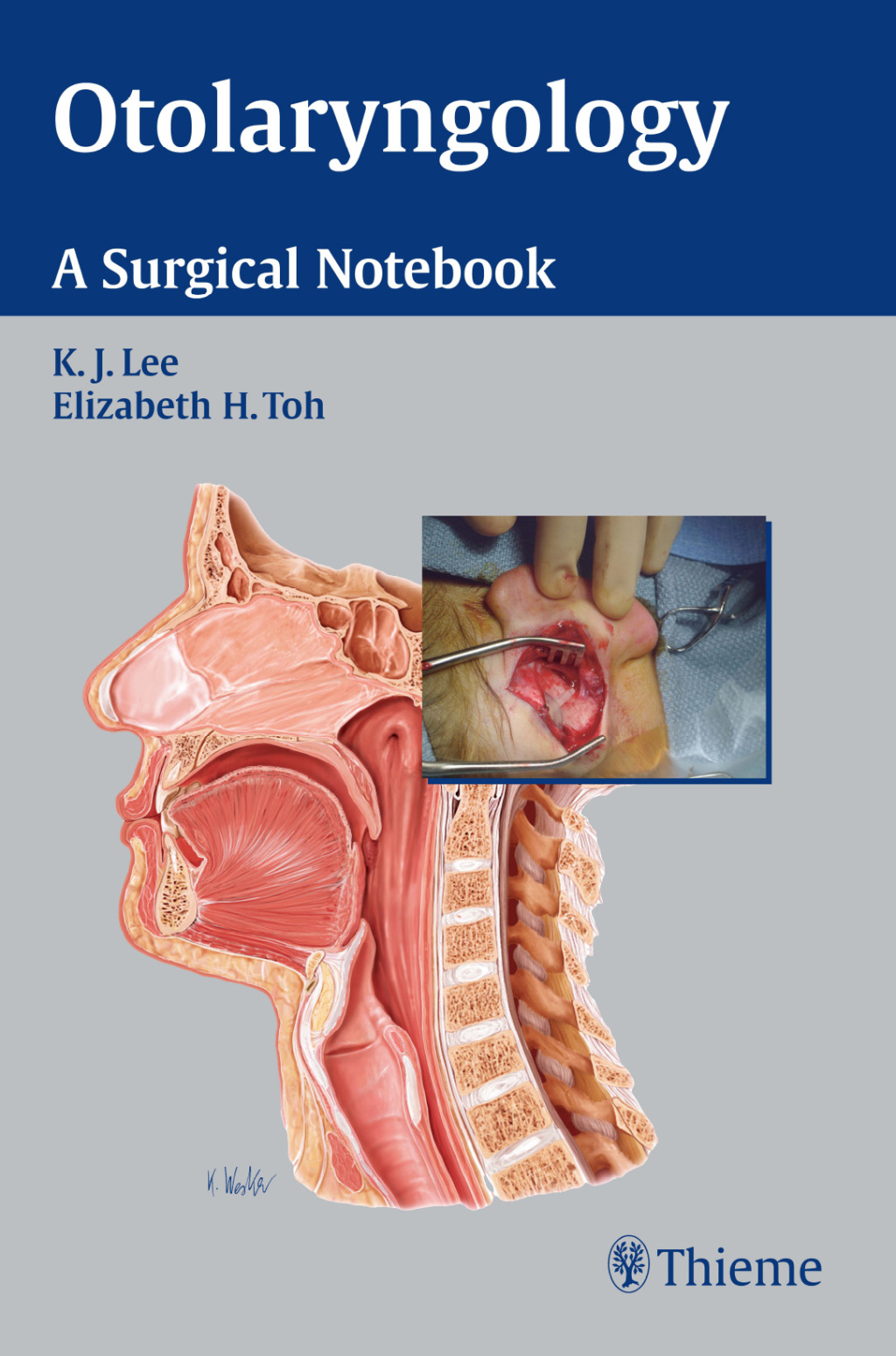 Otolaryngology A Surgical Notebook 1st Edition â€“ PDF/EPUB Version Downloadable