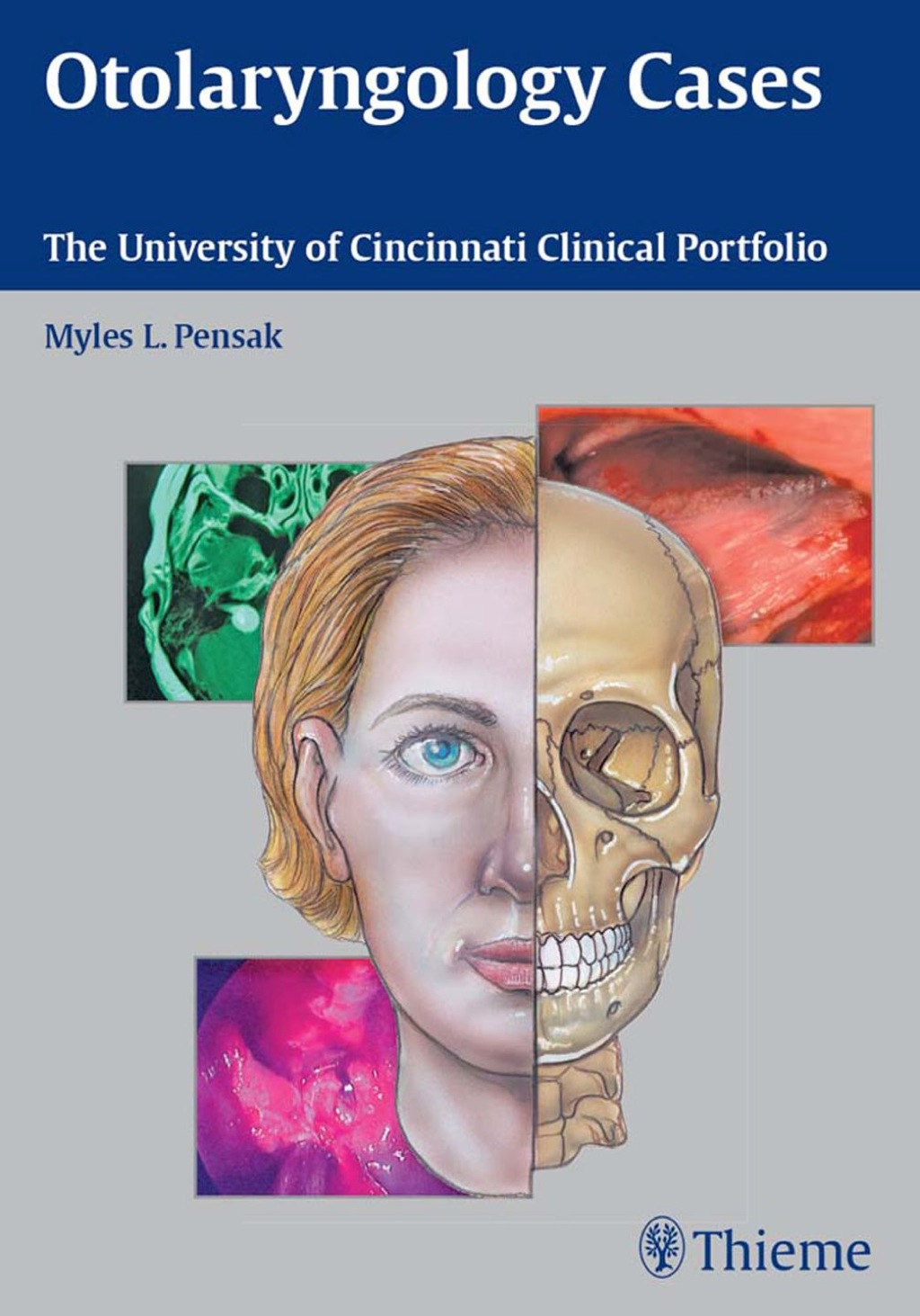 Otolaryngology Cases The University of Cincinnati Clinical Portfolio 1st Edition â€“ PDF/EPUB Version Downloadable