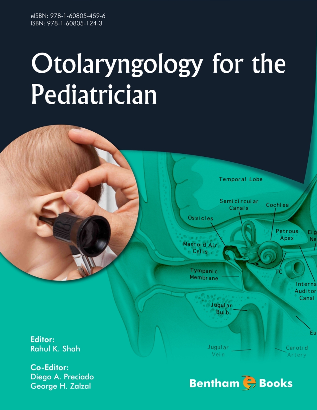 Otolaryngology for the Pediatrician 1st Edition â€“ PDF/EPUB Version Downloadable