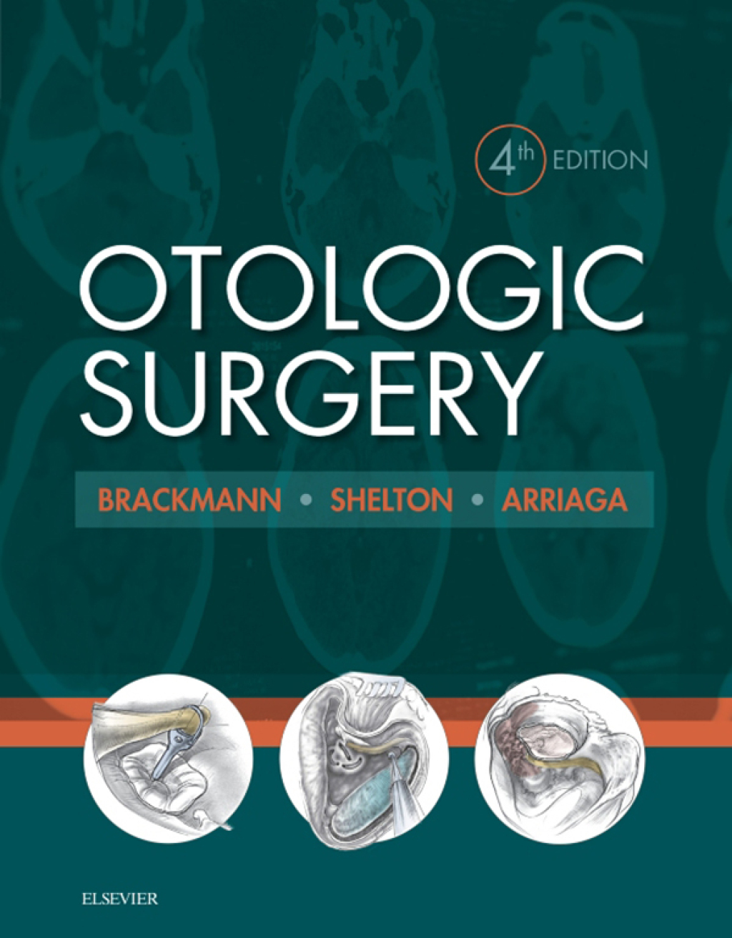 Otologic Surgery - Electronic 4th Edition â€“ PDF/EPUB Version Downloadable