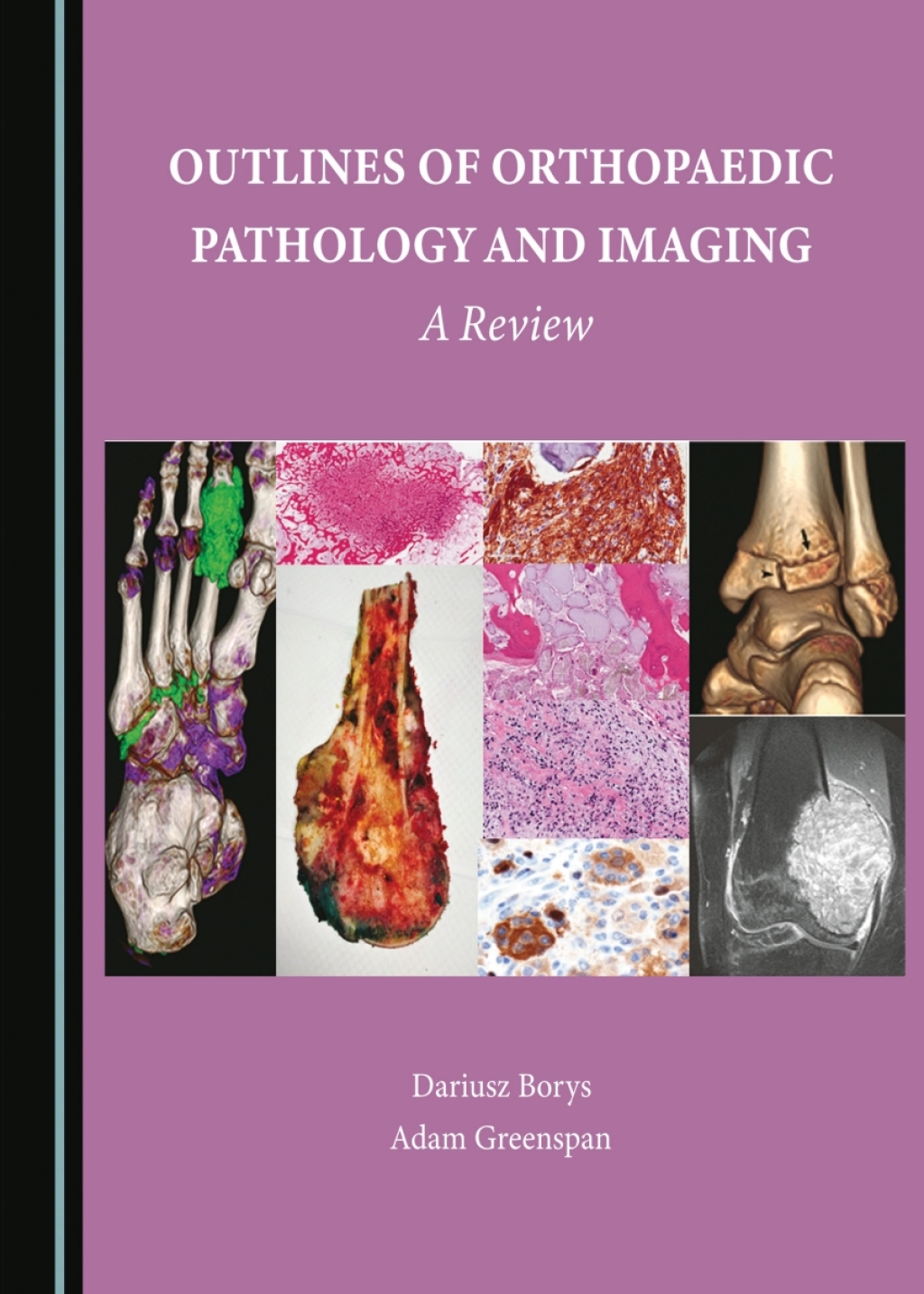 Outlines of Orthopaedic Pathology and Imaging A Review 1st Edition â€“ PDF/EPUB Version Downloadable