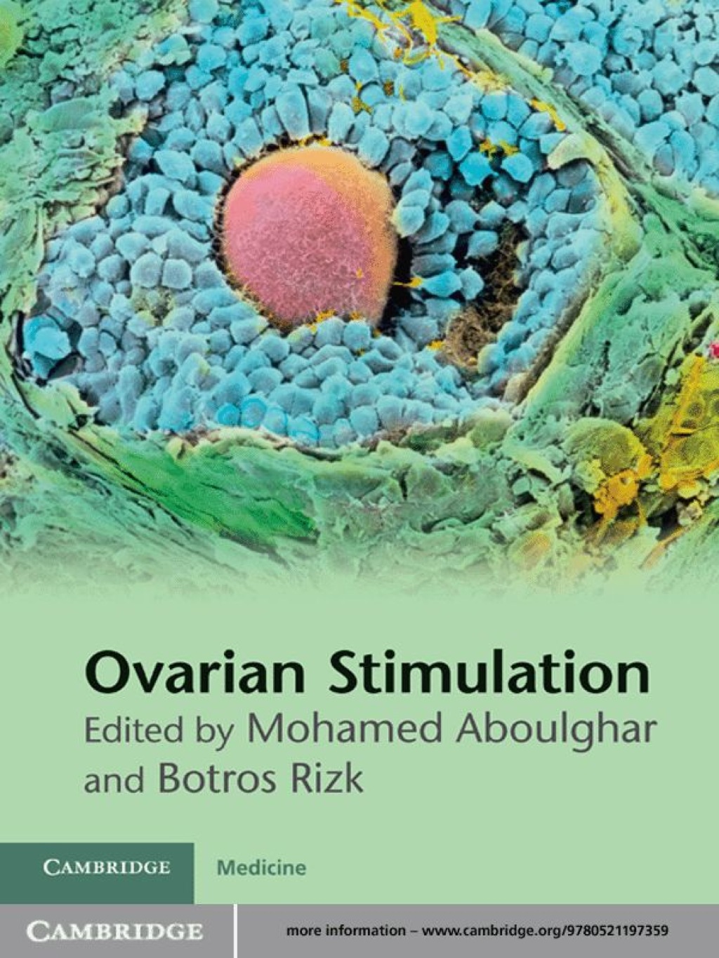 Ovarian Stimulation 1st Edition â€“ PDF/EPUB Version Downloadable