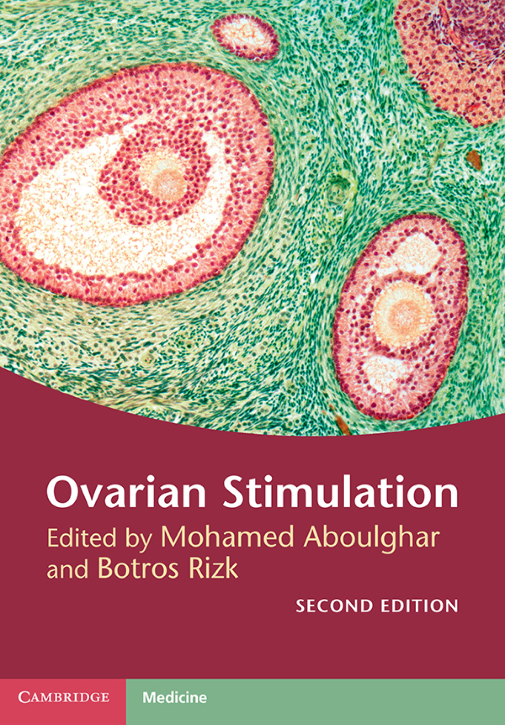 Ovarian Stimulation 2nd Edition â€“ PDF/EPUB Version Downloadable