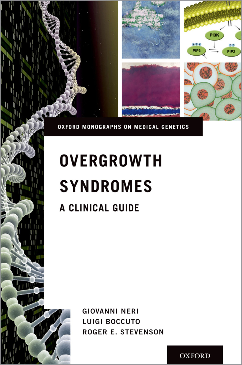 Overgrowth Syndromes A Clinical Guide 1st Edition â€“ PDF/EPUB Version Downloadable