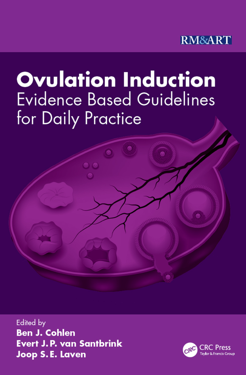Ovulation Induction Evidence Based Guidelines for Daily Practice 1st Edition â€“ PDF/EPUB Version Downloadable