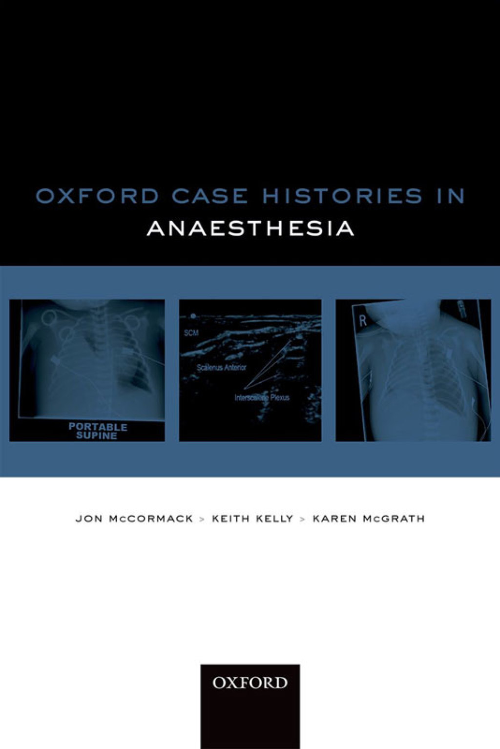Oxford Case Histories in Anaesthesia 1st Edition â€“ PDF/EPUB Version Downloadable