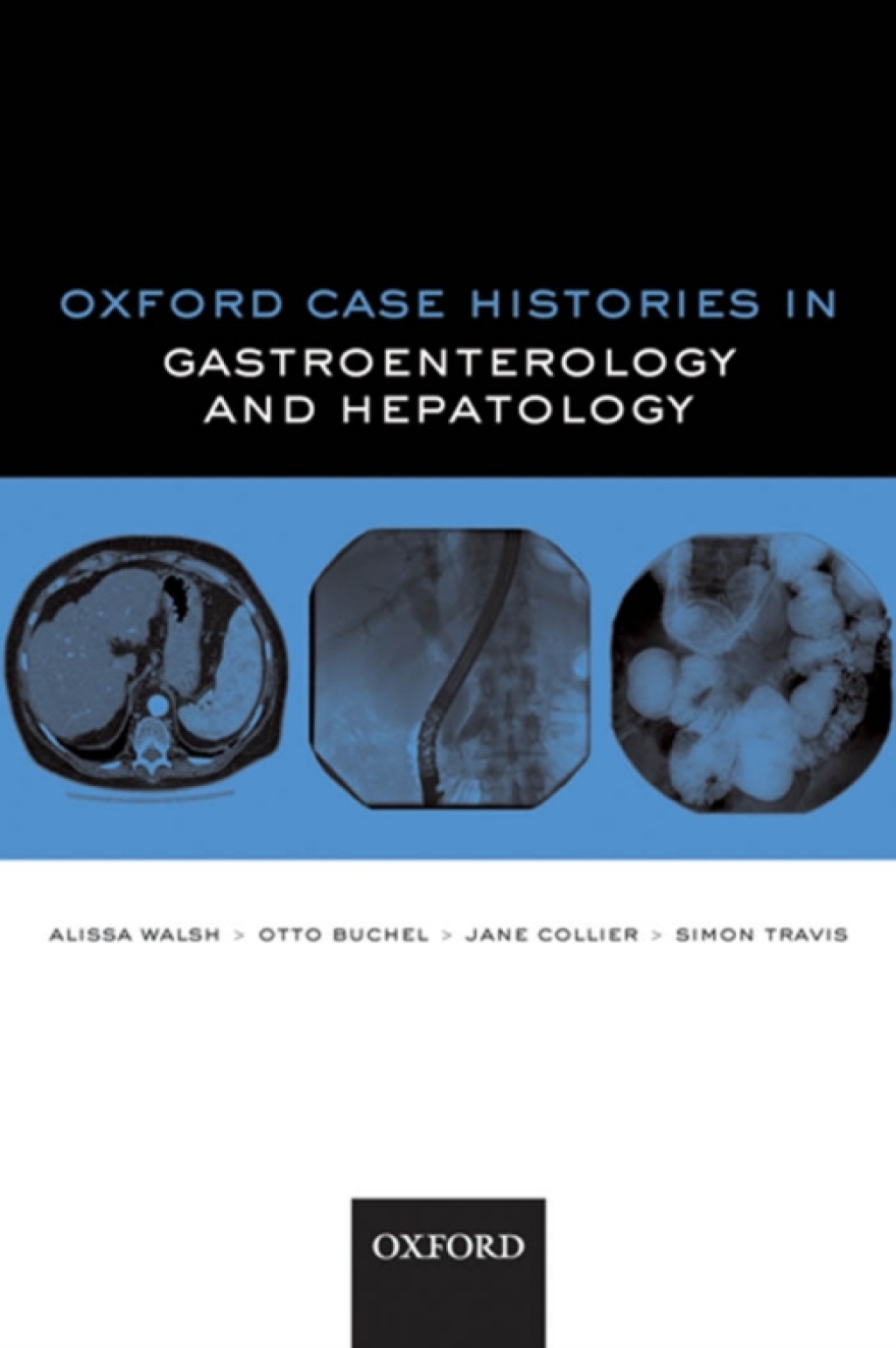 Oxford Case Histories in Gastroenterology and Hepatology  â€“ PDF/EPUB Version Downloadable