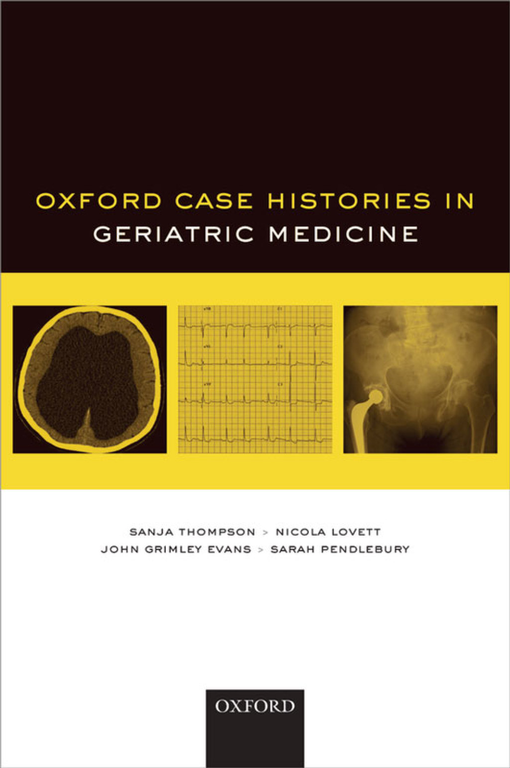 Oxford Case Histories in Geriatric Medicine 1st Edition â€“ PDF/EPUB Version Downloadable