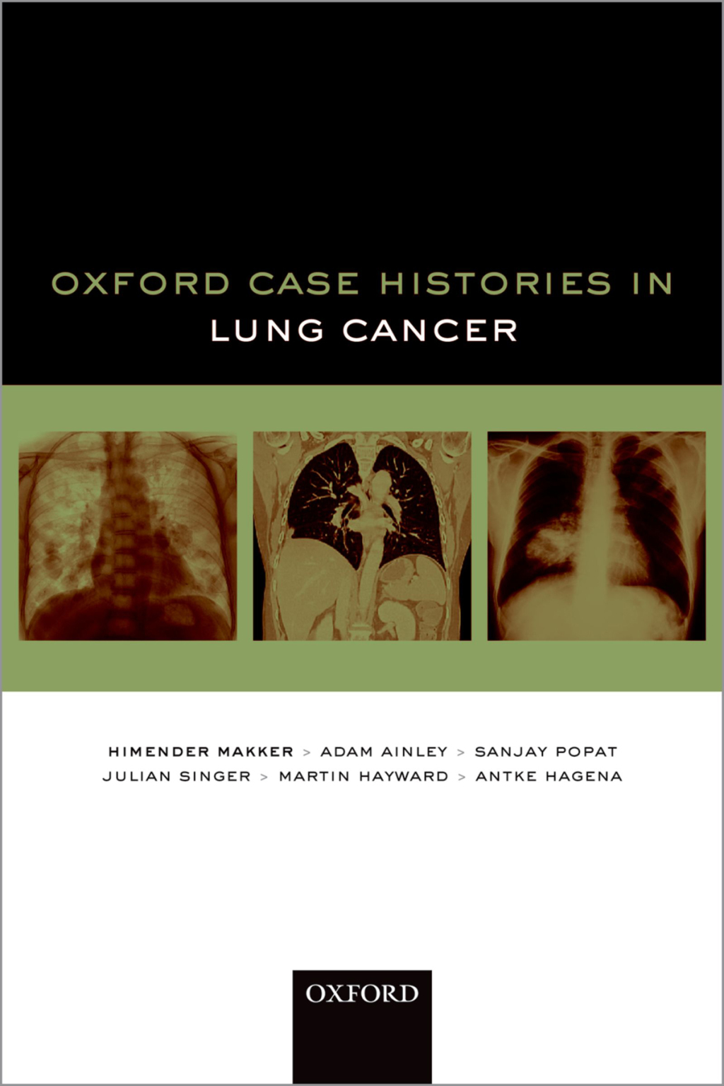 Oxford Case Histories in Lung Cancer  â€“ PDF/EPUB Version Downloadable