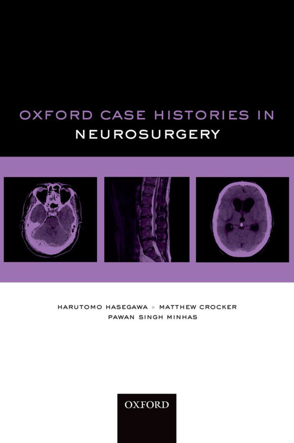 Oxford Case Histories in Neurosurgery  â€“ PDF/EPUB Version Downloadable