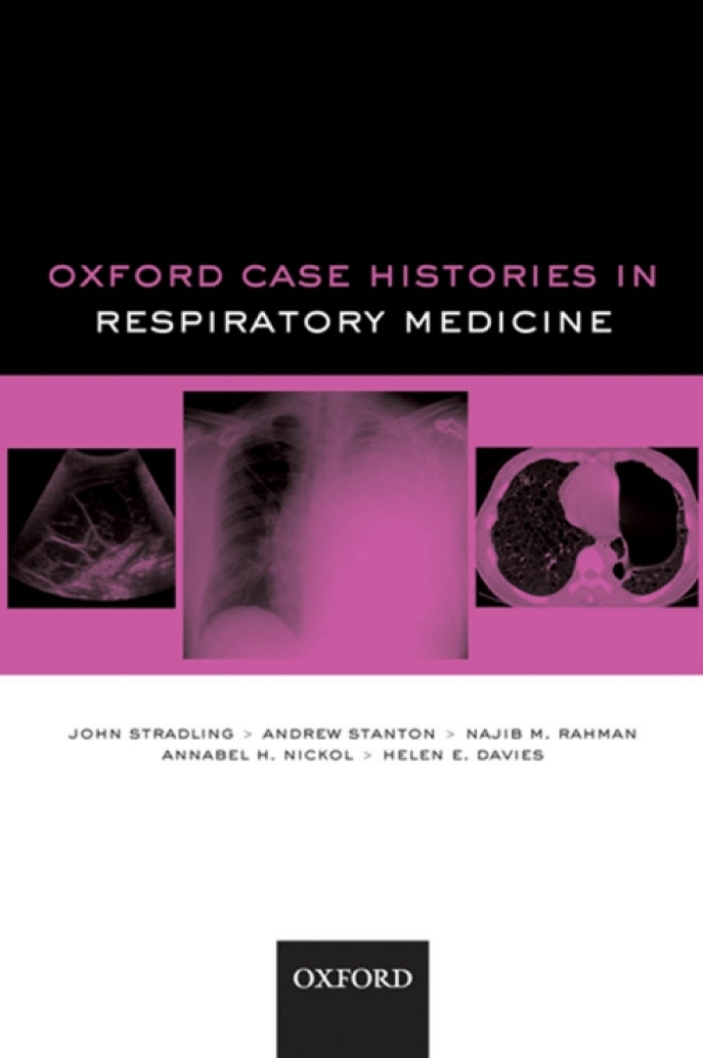Oxford Case Histories in Respiratory Medicine  â€“ PDF/EPUB Version Downloadable