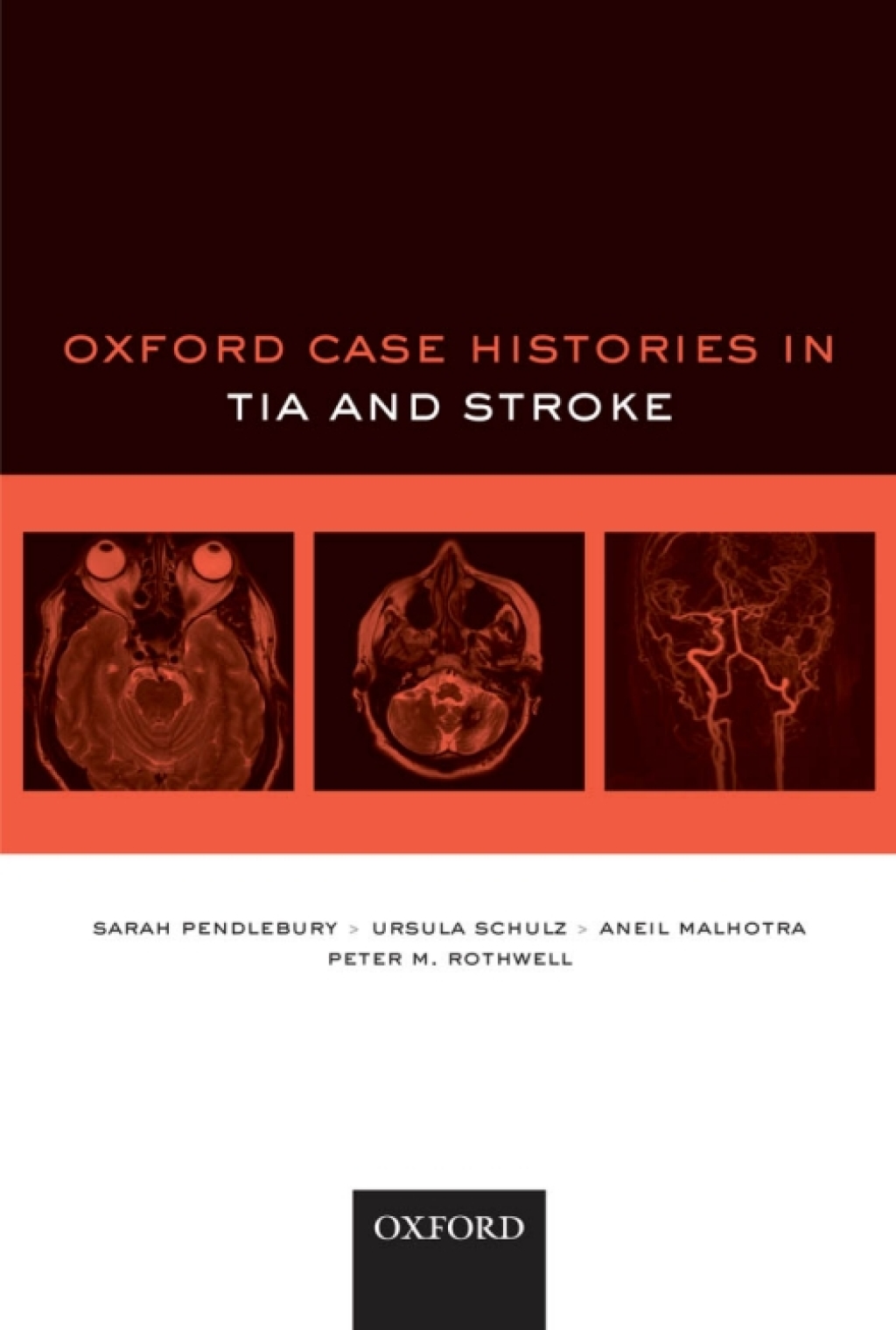 Oxford Case Histories in TIA and Stroke  â€“ PDF/EPUB Version Downloadable