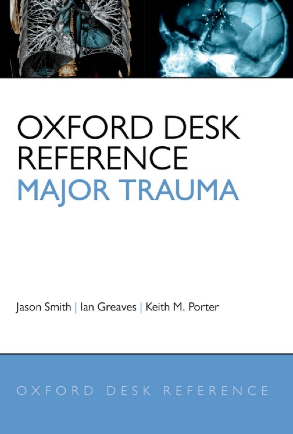 Oxford Desk Reference: Major Trauma  â€“ PDF/EPUB Version Downloadable
