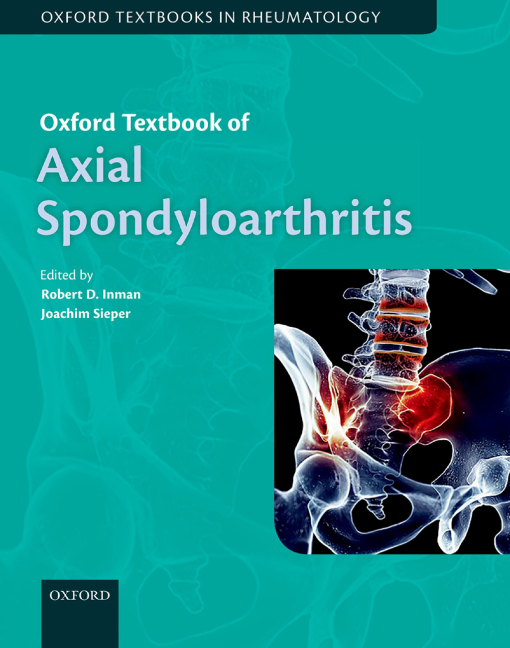 Oxford Textbook of Axial Spondyloarthritis 1st Edition â€“ PDF/EPUB Version Downloadable
