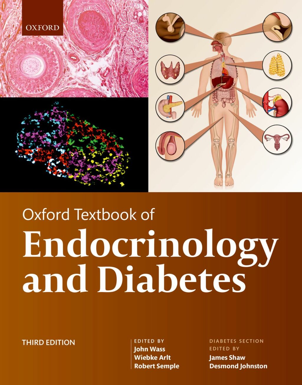 Oxford Textbook of Endocrinology and Diabetes 3rd Edition â€“ PDF/EPUB Version Downloadable