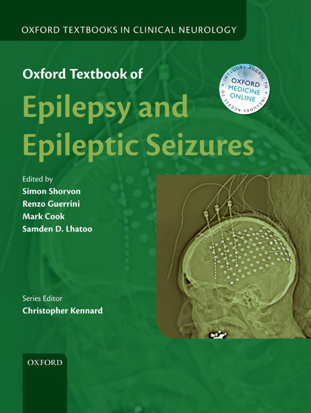 Oxford Textbook of Epilepsy and Epileptic Seizures 1st Edition â€“ PDF/EPUB Version Downloadable
