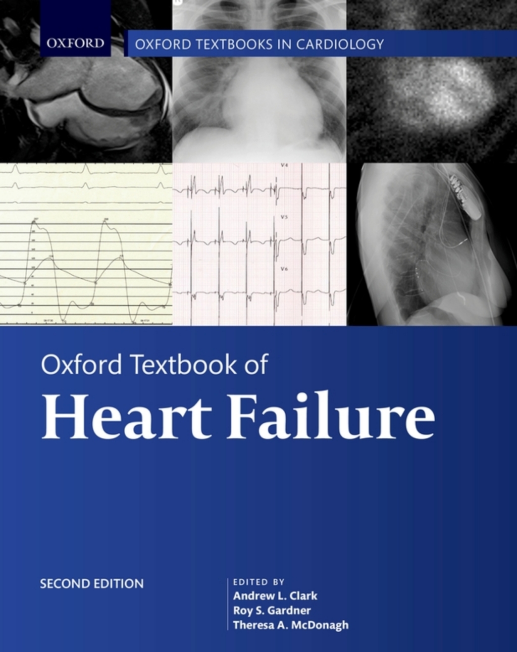 Oxford Textbook of Heart Failure 2nd Edition â€“ PDF/EPUB Version Downloadable
