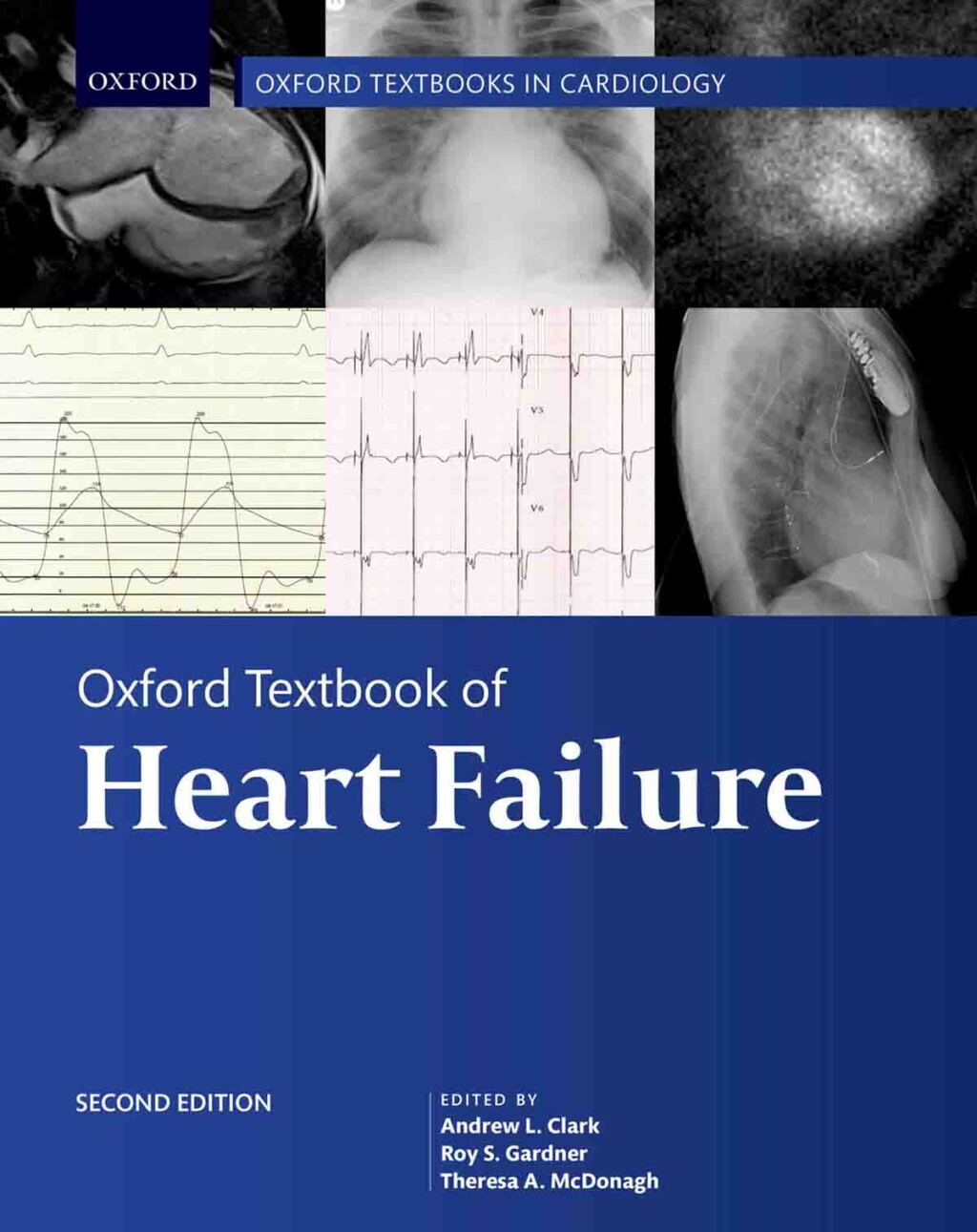 Oxford Textbook of Heart Failure 2nd Edition â€“ PDF/EPUB Version Downloadable
