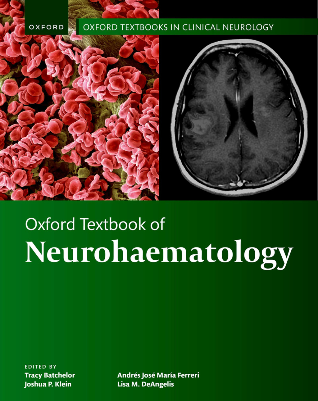Oxford Textbook of Neurohaematology 1st Edition â€“ PDF/EPUB Version Downloadable