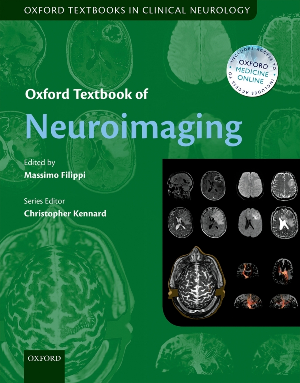 Oxford Textbook of Neuroimaging 1st Edition â€“ PDF/EPUB Version Downloadable