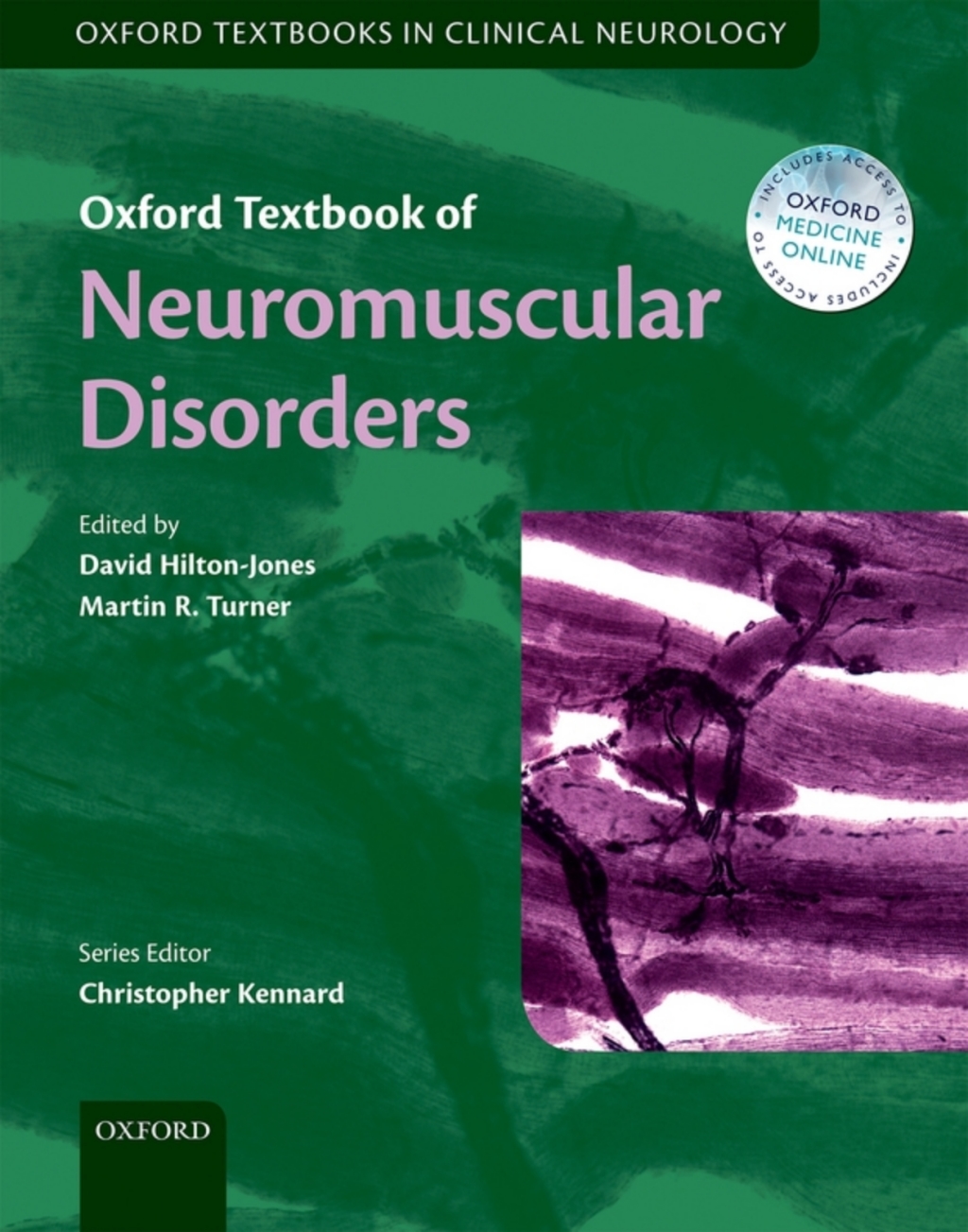 Oxford Textbook of Neuromuscular Disorders 1st Edition â€“ PDF/EPUB Version Downloadable