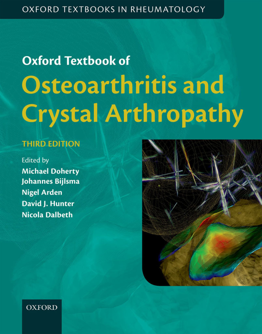 Oxford Textbook of Osteoarthritis and Crystal Arthropathy 3rd Edition â€“ PDF/EPUB Version Downloadable