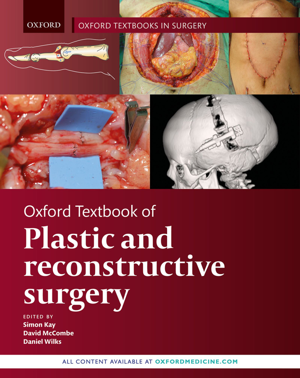 Oxford Textbook of Plastic and Reconstructive Surgery  â€“ PDF/EPUB Version Downloadable