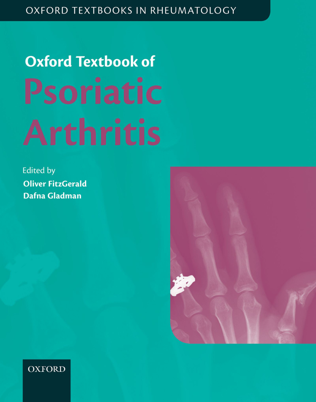 Oxford Textbook of Psoriatic Arthritis 1st Edition â€“ PDF/EPUB Version Downloadable