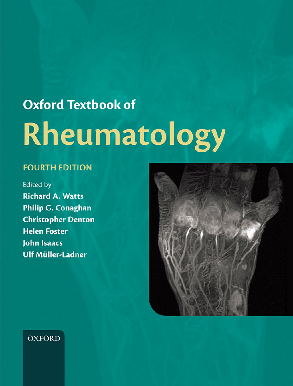 Oxford Textbook of Rheumatology 4th Edition â€“ PDF/EPUB Version Downloadable