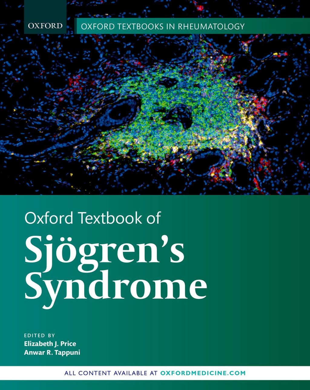 Oxford Textbook of SjÃ¶gren's Syndrome  â€“ PDF/EPUB Version Downloadable