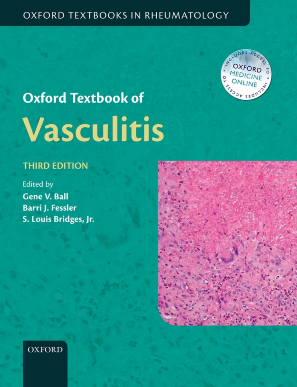 Oxford Textbook of Vasculitis 3rd Edition â€“ PDF/EPUB Version Downloadable