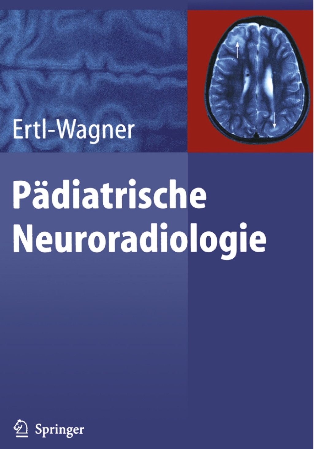 PÃ¤diatrische Neuroradiologie  â€“ PDF/EPUB Version Downloadable