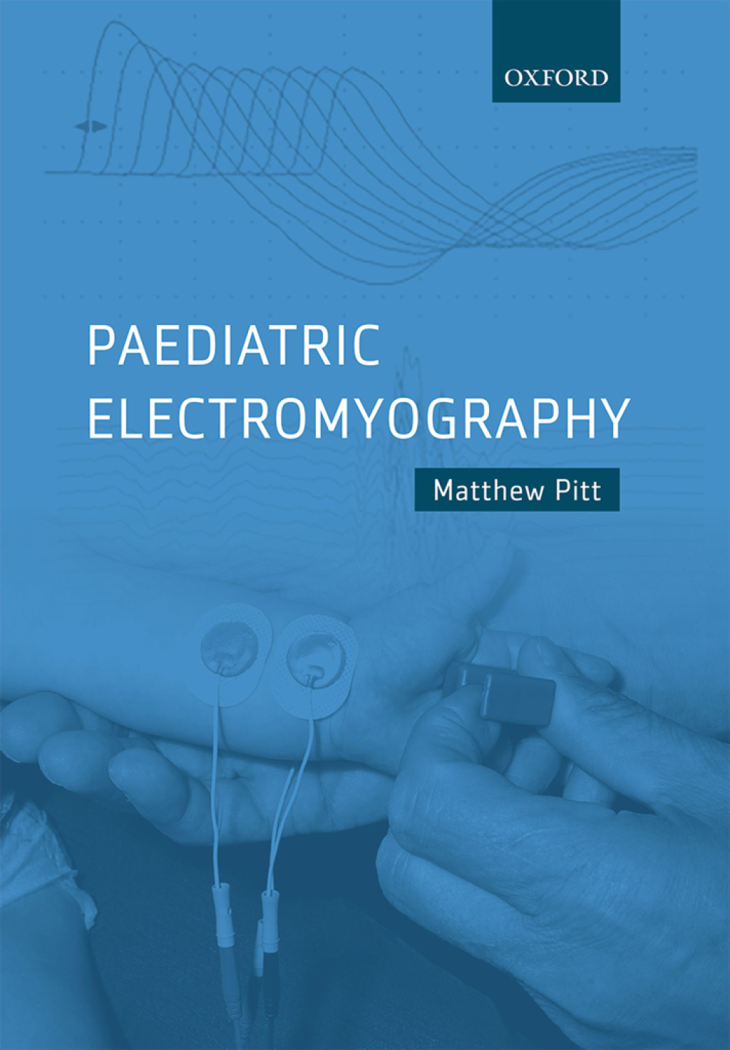 Paediatric Electromyography 1st Edition â€“ PDF/EPUB Version Downloadable
