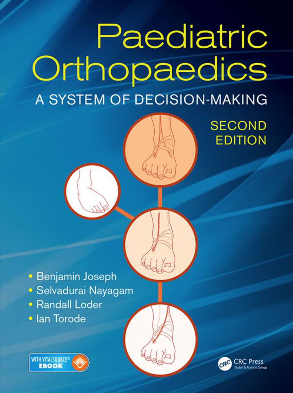 Paediatric Orthopaedics A System of Decision-Making, Second Edition 2nd Edition â€“ PDF/EPUB Version Downloadable
