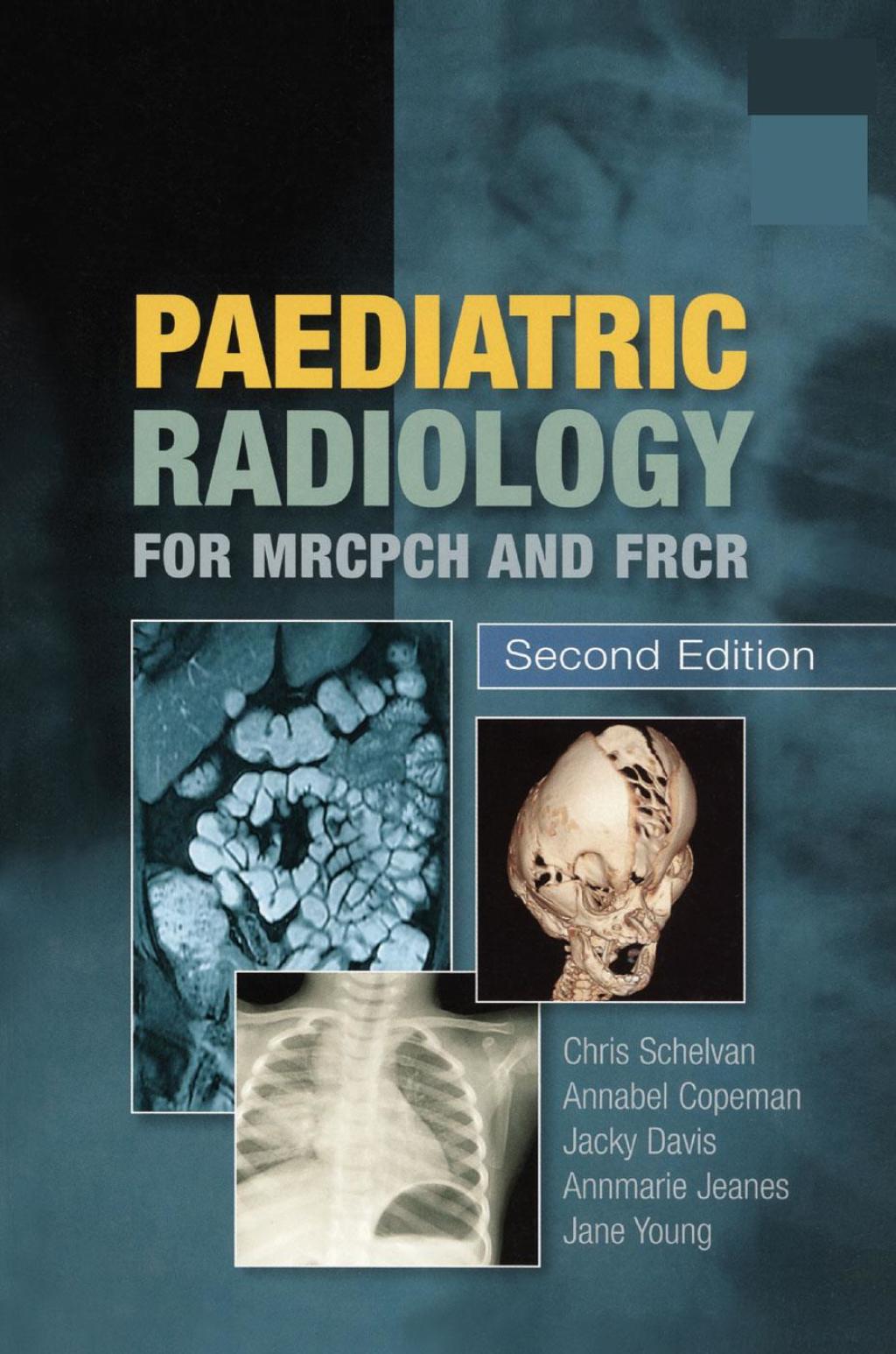 Paediatric Radiology for MRCPCH and FRCR, Second Edition 2nd Edition â€“ PDF/EPUB Version Downloadable