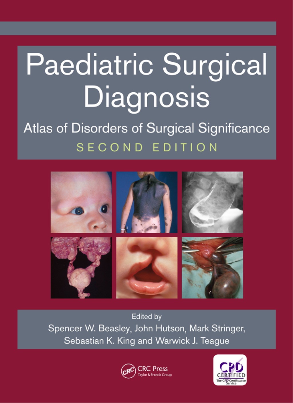 Paediatric Surgical Diagnosis Atlas of Disorders of Surgical Significance, Second Edition 2nd Edition â€“ PDF/EPUB Version Downloadable