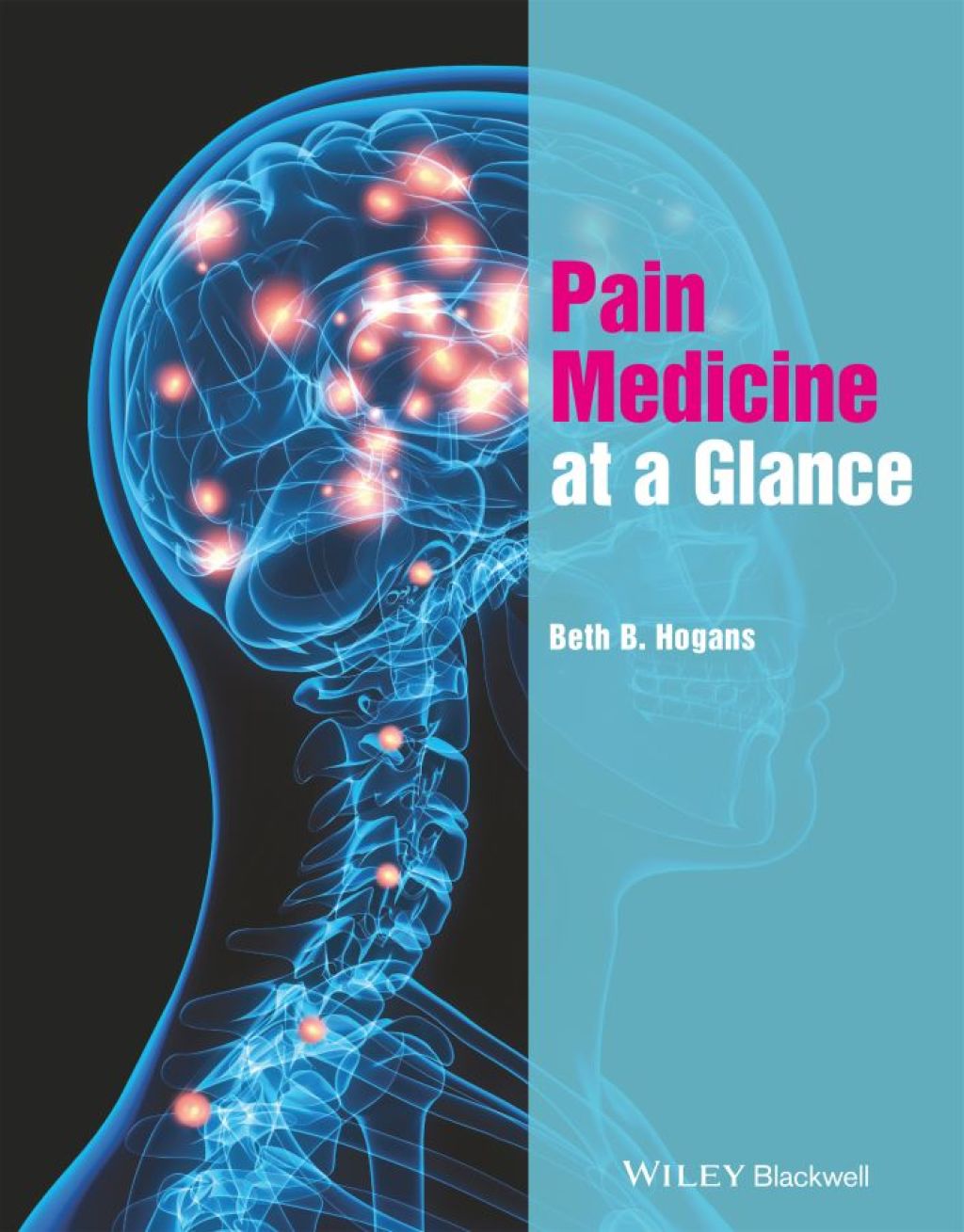 Pain Medicine at a Glance 1st Edition â€“ PDF/EPUB Version Downloadable