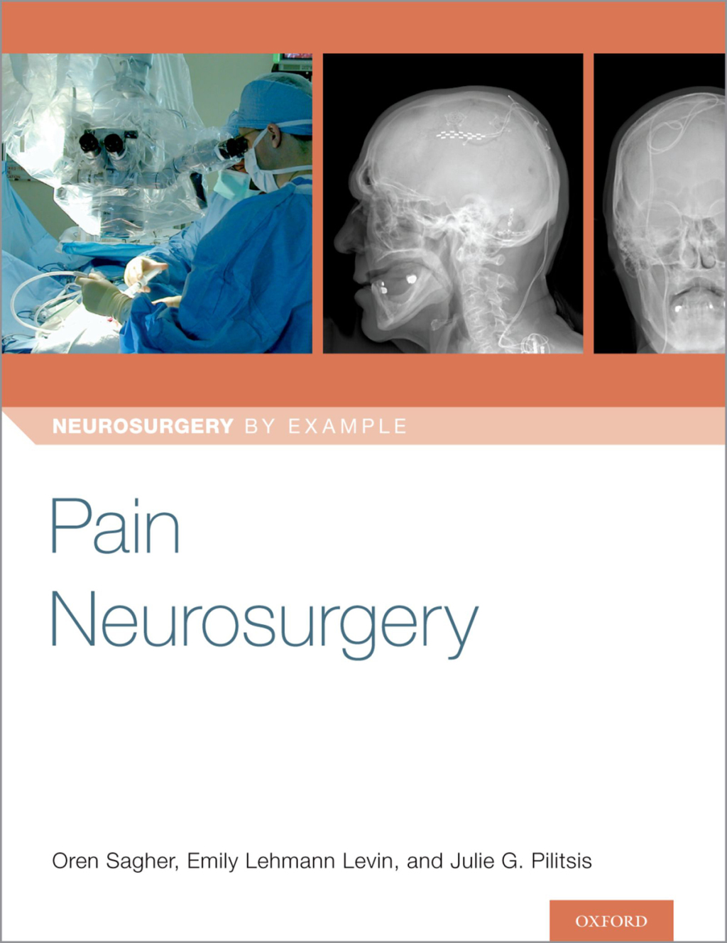 Pain Neurosurgery 1st Edition â€“ PDF/EPUB Version Downloadable